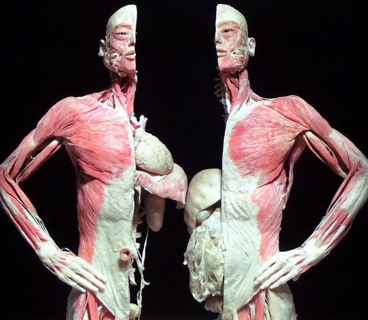Bodies, the Exhibition
